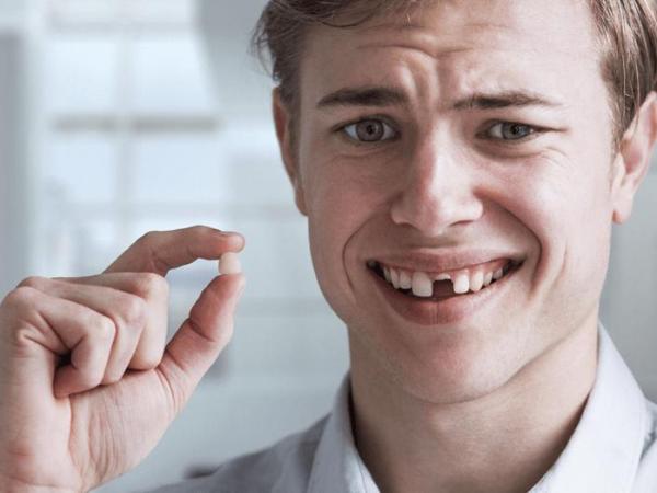 What to do if your tooth is&nbsp;missing